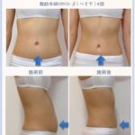 高速美肌脱毛/フェイシャル専門店　If me イメージ