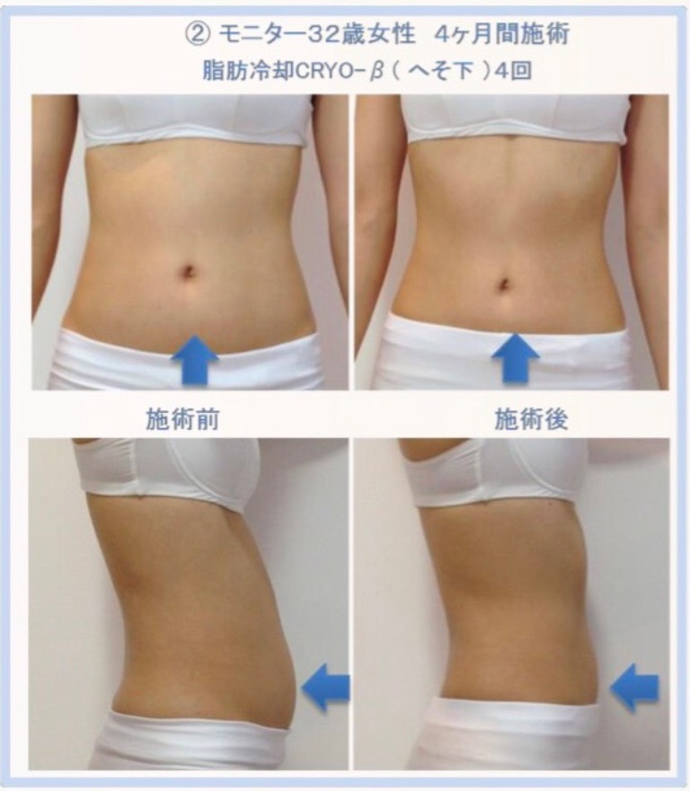 高速美肌脱毛/フェイシャル専門店　If me イメージ